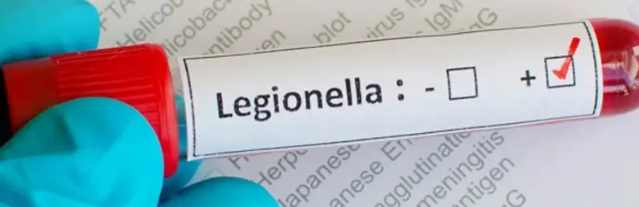 Why Do I Need A Legionella Risk Assessment